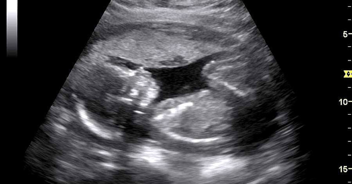 Rely on the very best fake pregnancy ultrasound