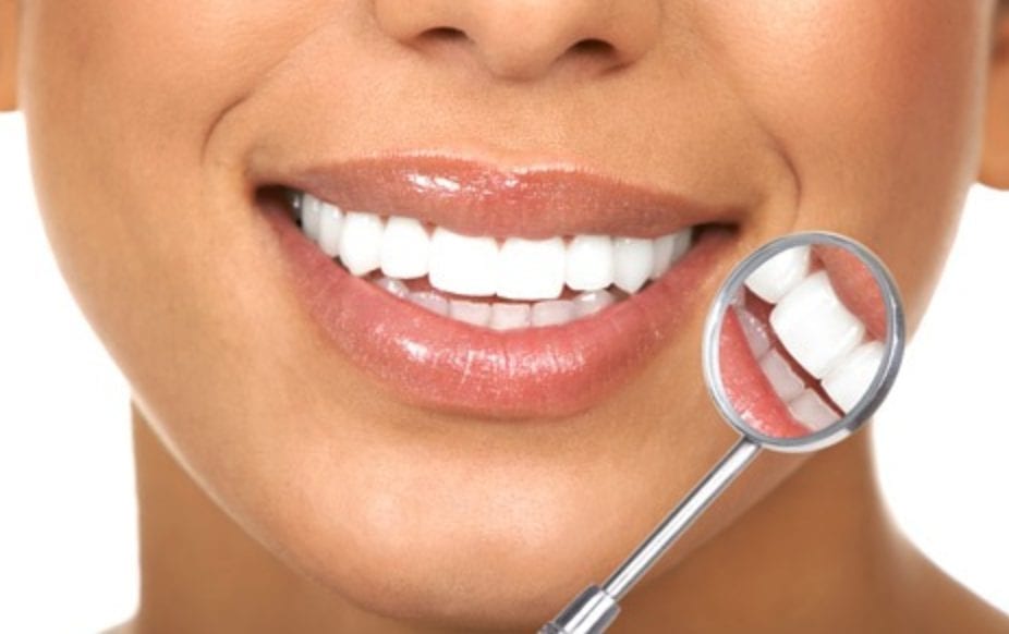 How long does teeth whitening in Covent Garden last?